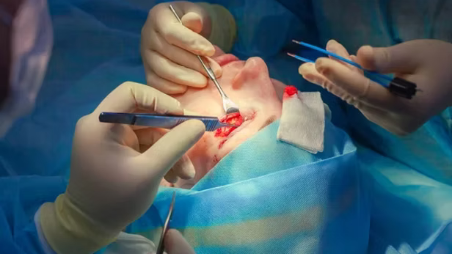 Gastroenterology